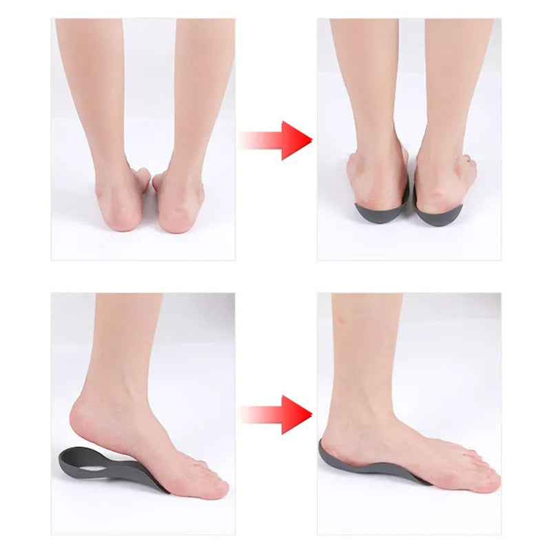 XO-Legs Orthopedic Insoles Orthotics Flat Foot Health Sole Pad for Shoes Insert Arch Support Pad for Plantar Fasciitis Feet Care